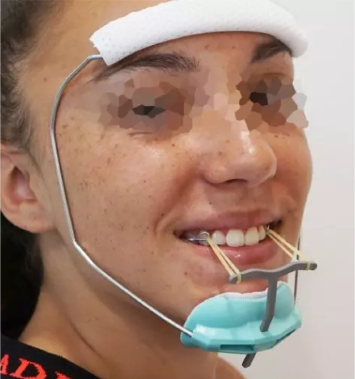 Masque de
                        Delaire